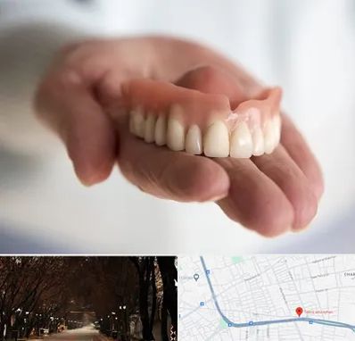 لیفت لثه با لیزر در ابوریحان تبریز