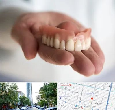 لیفت لثه با لیزر در امامت مشهد