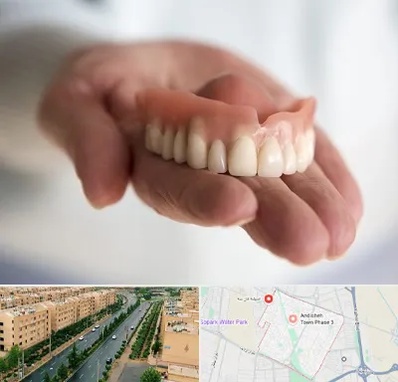 لیفت لثه با لیزر در فاز سه اندیشه