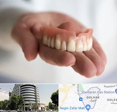 لیفت لثه با لیزر در قلهک 