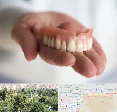 لیفت لثه با لیزر در منطقه 13 تهران