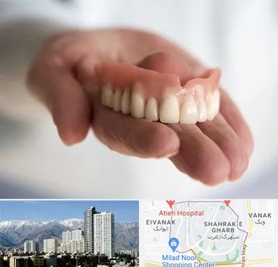 لیفت لثه با لیزر در شهرک غرب 