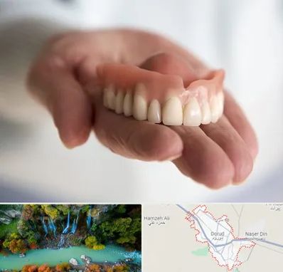لیفت لثه با لیزر در دورود