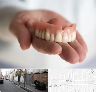 لیفت لثه با لیزر در خیابان نامجو