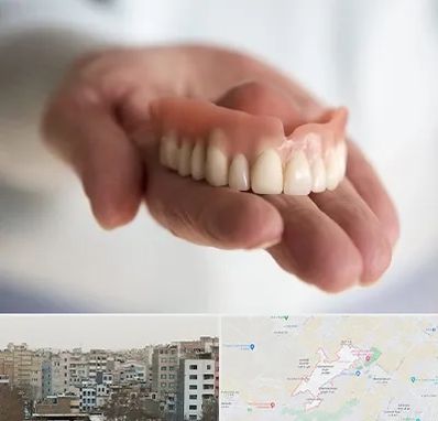 لیفت لثه با لیزر در محمد شهر کرج