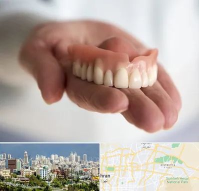 لیفت لثه با لیزر در شرق تهران 