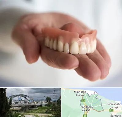 لیفت لثه با لیزر در چالوس