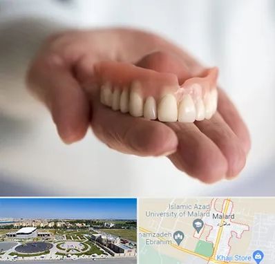 لیفت لثه با لیزر در ملارد