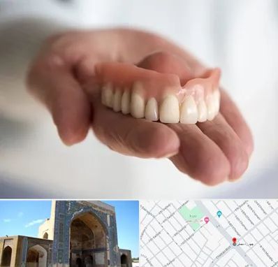 لیفت لثه با لیزر در مصلی مشهد