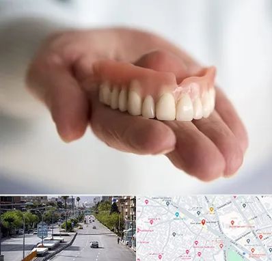 لیفت لثه با لیزر در خیابان زند شیراز