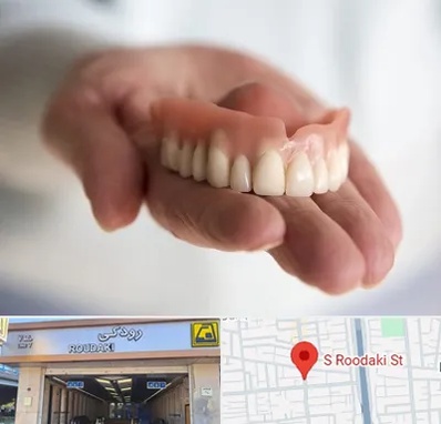 لیفت لثه با لیزر در رودکی