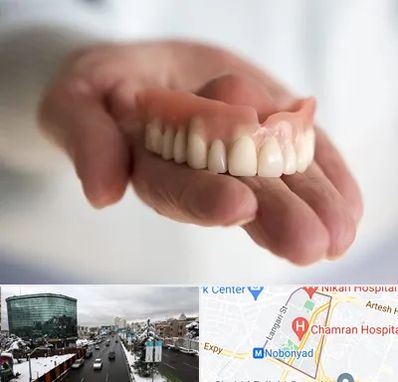 لیفت لثه با لیزر در اقدسیه 