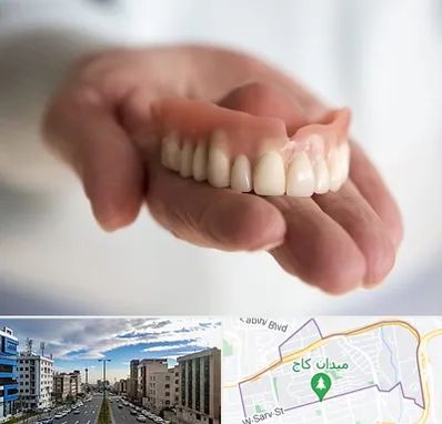 لیفت لثه با لیزر در سعادت آباد 