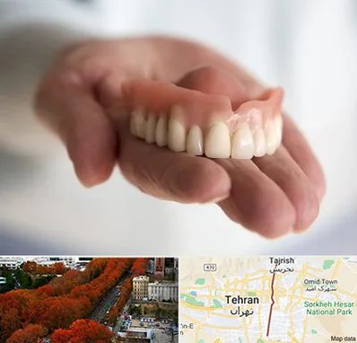 لیفت لثه با لیزر در ولیعصر 