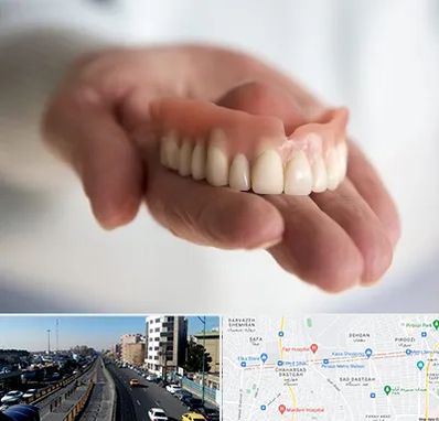 لیفت لثه با لیزر در پیروزی 