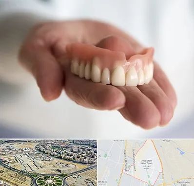 لیفت لثه با لیزر در اندیشه