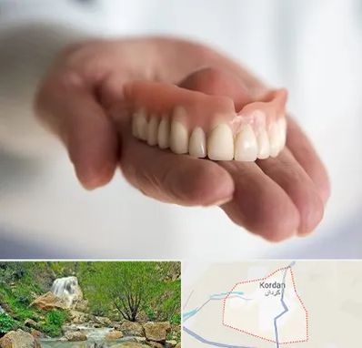 لیفت لثه با لیزر در کردان