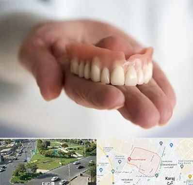 لیفت لثه با لیزر در شاهین ویلا کرج