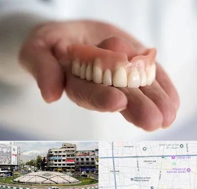 لیفت لثه با لیزر در مرکز تهران