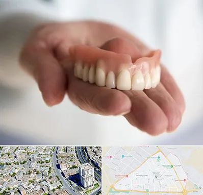 لیفت لثه با لیزر در قاسم آباد مشهد