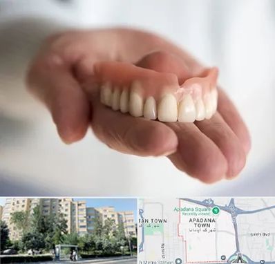 لیفت لثه با لیزر در آپادانا