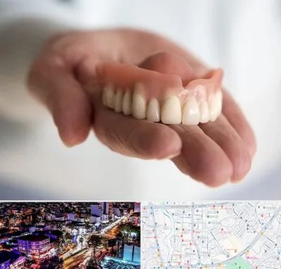 لیفت لثه با لیزر در منظریه رشت