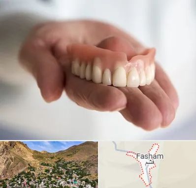 لیفت لثه با لیزر در فشم