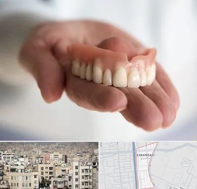 لیفت لثه با لیزر در اسکندری