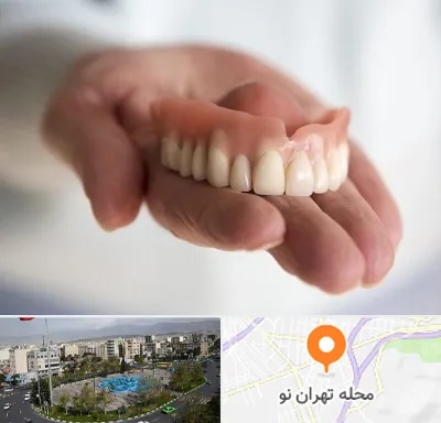 لیفت لثه با لیزر در تهران نو