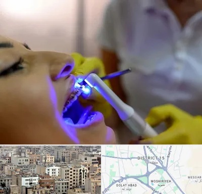 دندانپزشکی با لیزر در جنوب شرق تهران