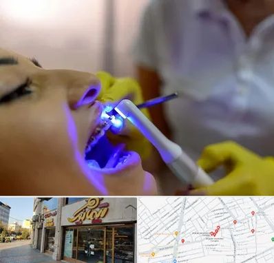 دندانپزشکی با لیزر در عطاران قم