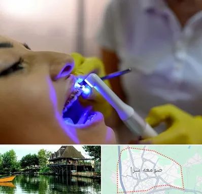 دندانپزشکی با لیزر در صومعه سرا