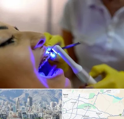 دندانپزشکی با لیزر در شمال شرق تهران