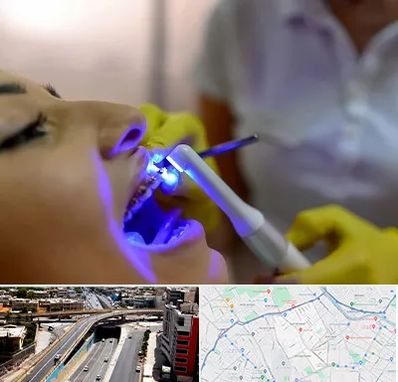 دندانپزشکی با لیزر در ستارخان شیراز