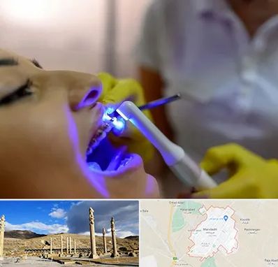 دندانپزشکی با لیزر در مرودشت