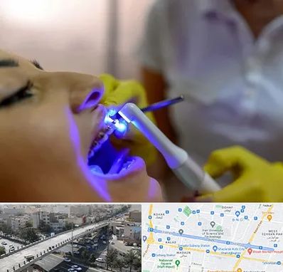 دندانپزشکی با لیزر در فرجام