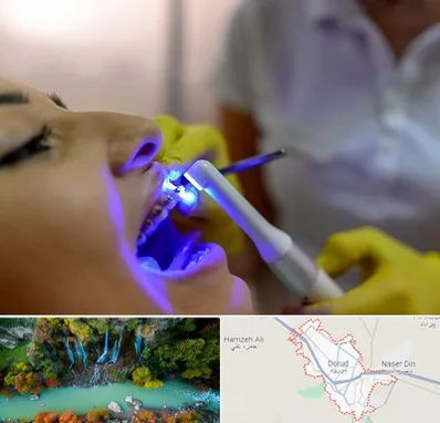 دندانپزشکی با لیزر در دورود