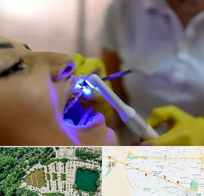 دندانپزشکی با لیزر در وکیل آباد مشهد
