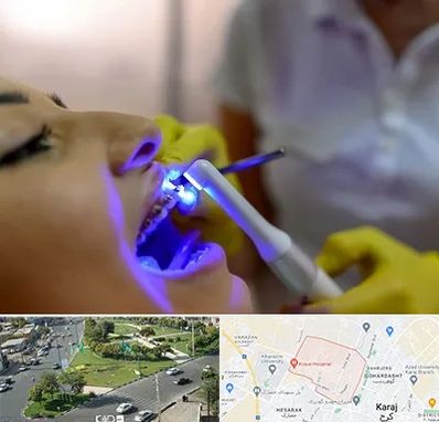 دندانپزشکی با لیزر در شاهین ویلا کرج
