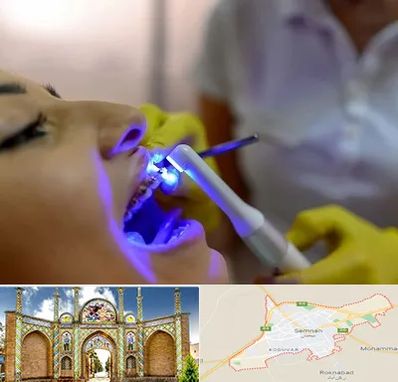 دندانپزشکی با لیزر در سمنان
