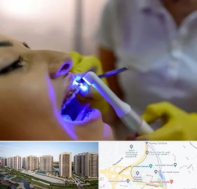 دندانپزشکی با لیزر در المپیک 