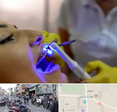 دندانپزشکی با لیزر در چهارراه استانبول