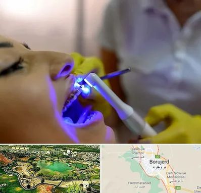 دندانپزشکی با لیزر در بروجرد