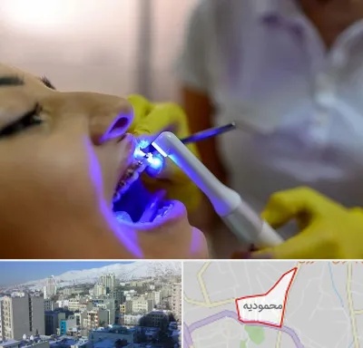 دندانپزشکی با لیزر در محمودیه