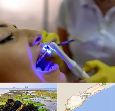 دندانپزشکی با لیزر در بندرلنگه