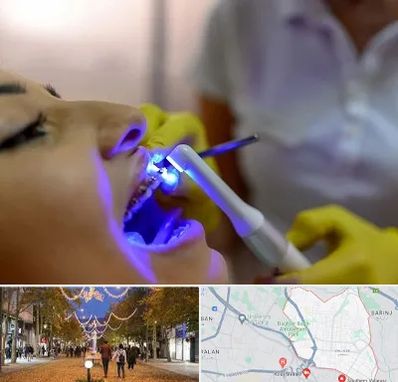 دندانپزشکی با لیزر در ولیعصر ارومیه