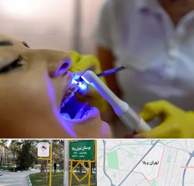 دندانپزشکی با لیزر در تهران ویلا