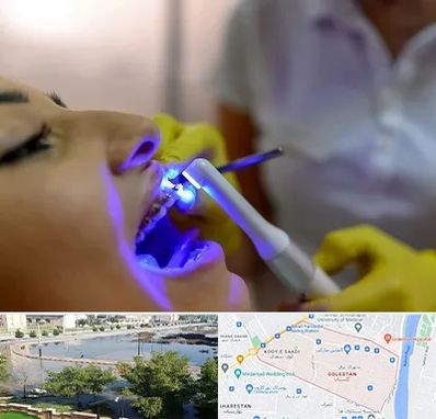 دندانپزشکی با لیزر در گلستان اهواز