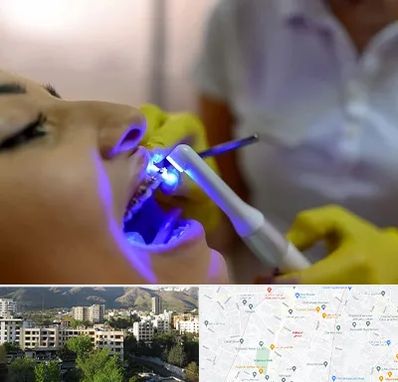 دندانپزشکی با لیزر در دیباجی