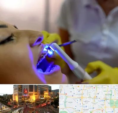 دندانپزشکی با لیزر در جنت آباد تهران 